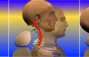 Adhesivo estructural TEROSON EP 5055